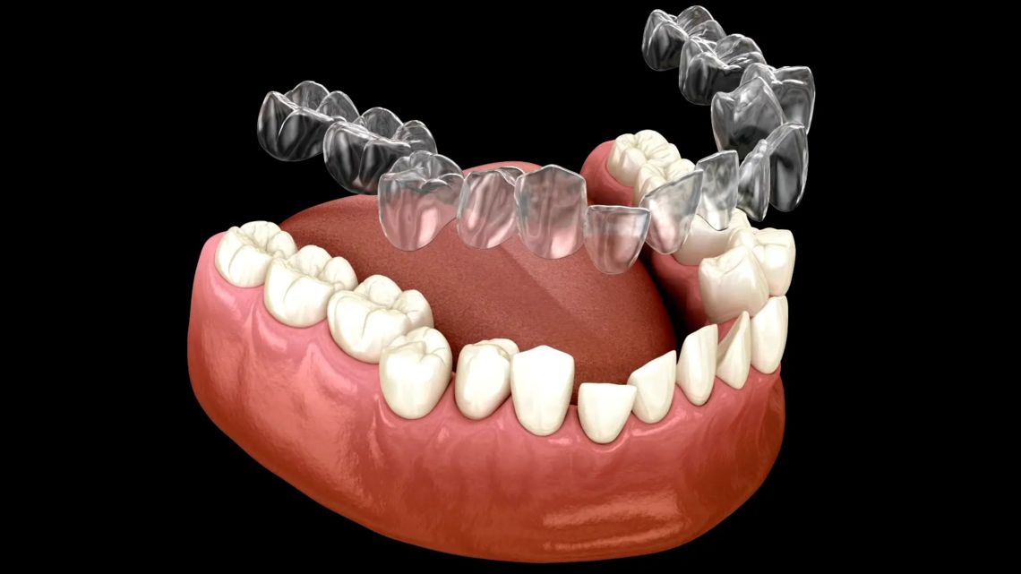 3D Teeth Scanner: A digital alternative to messy mouth moulds