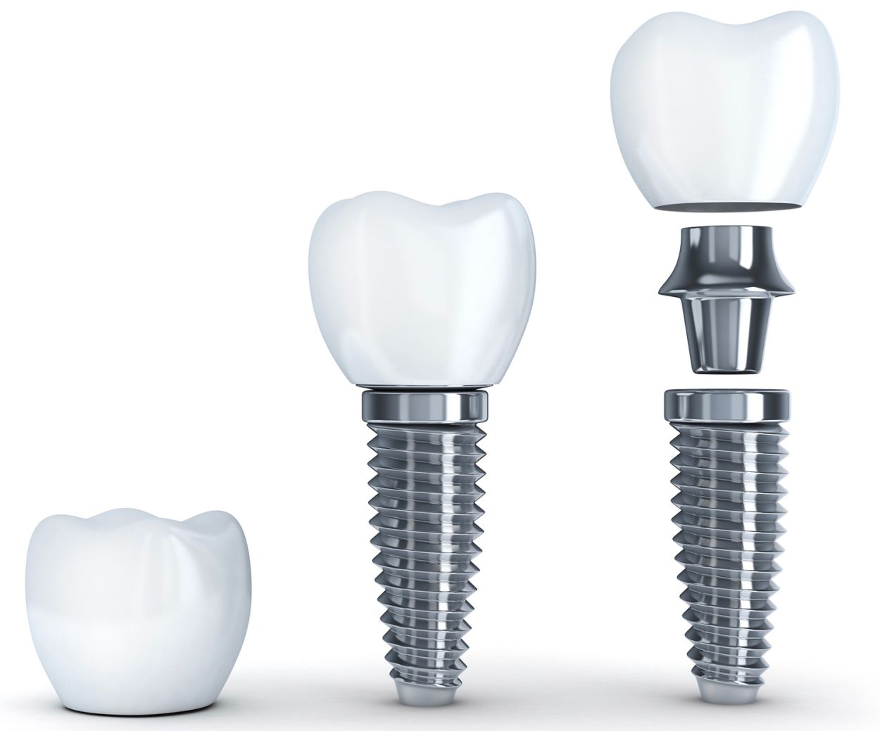 single implant