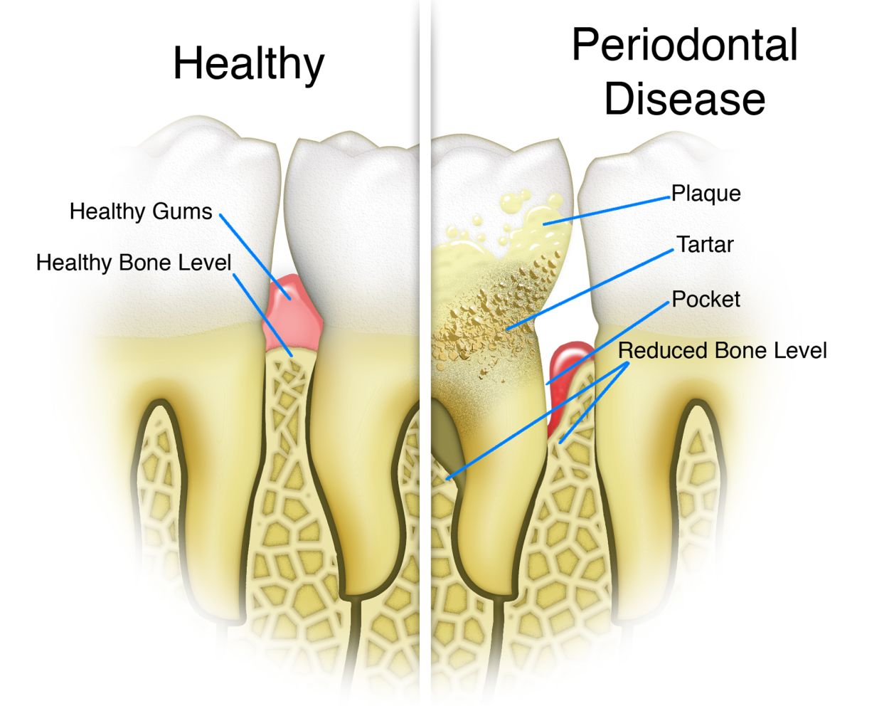 Oral Hygiene Demo