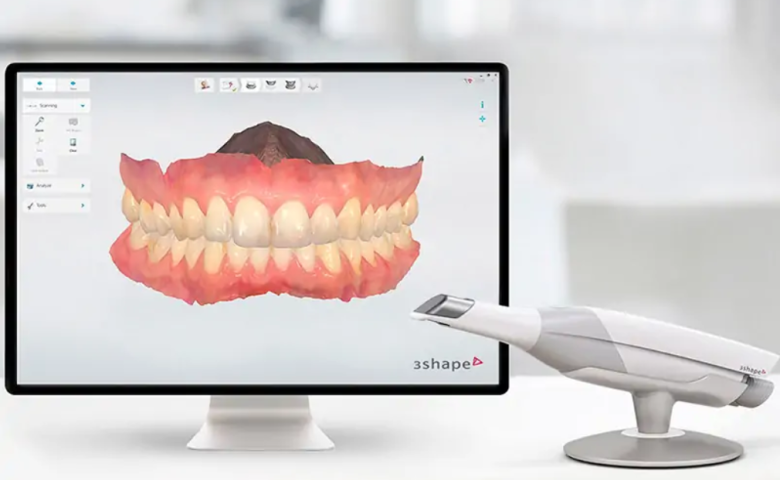 Intra Oral Scanner 
