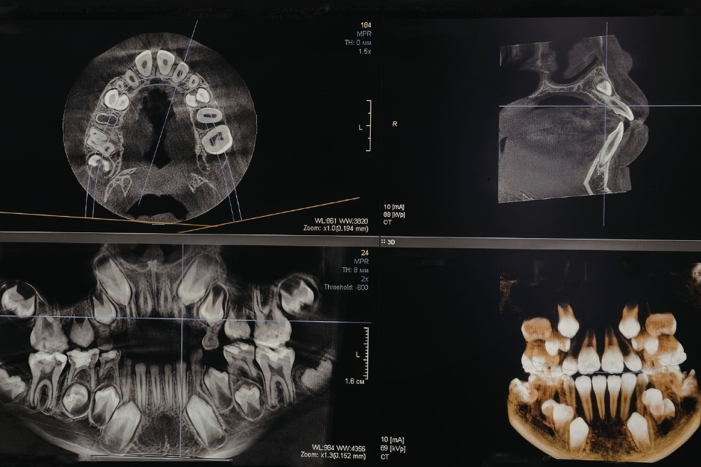 cbct